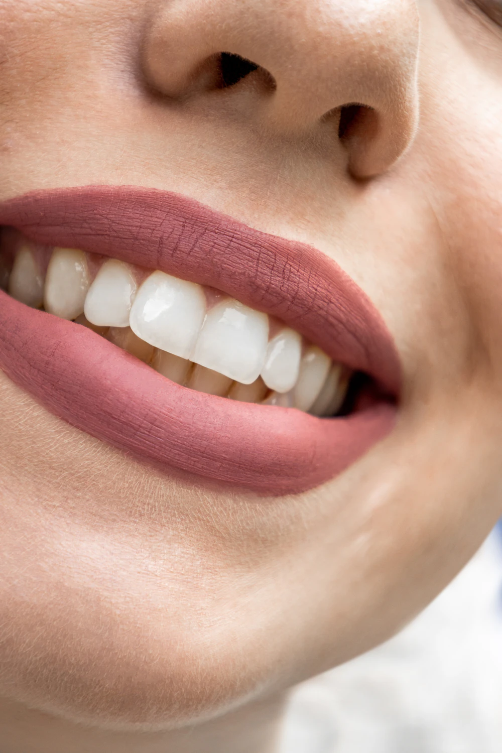 Sonrisa antes del tratamiento